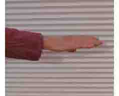 this picture and next show arm starting with palm down and then turning to palm up.